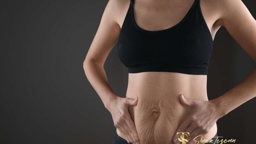 benefits-and-harms-of-having-a-tummy-tuck-operation